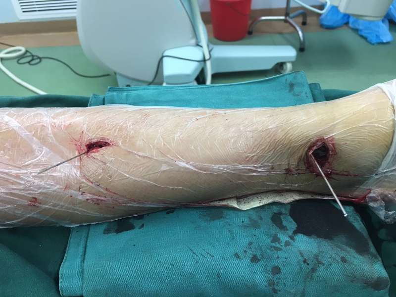 888845851785793726.jpg 888845851785793726.jpg